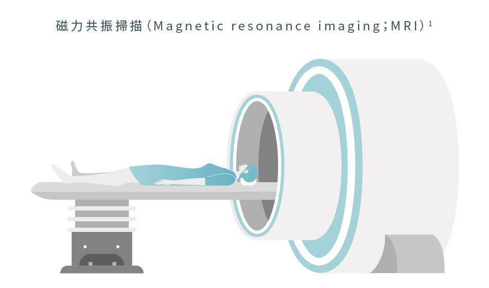 磁力共振掃描 (MRI) 有助監測大腸癌狀況
