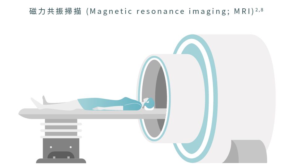 磁力共振掃描 (MRI) 能夠檢測類風濕性關節炎